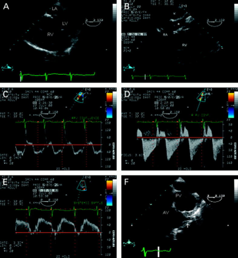 Figure 11  