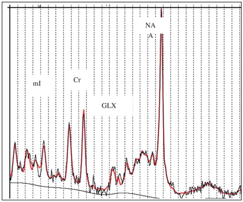 FIG. 3