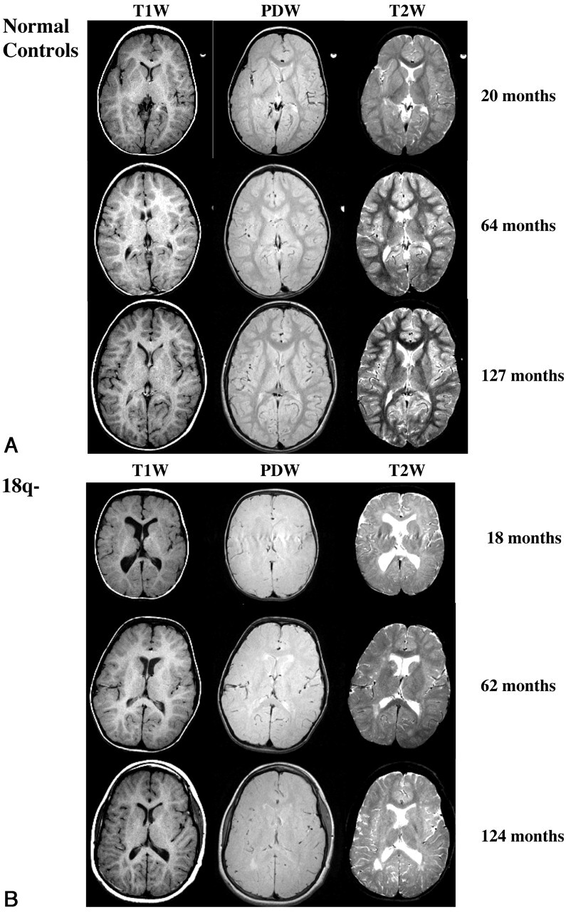 Fig 1.