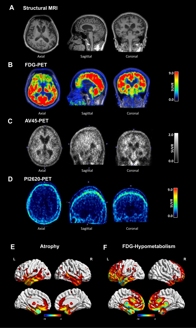 Fig. 2