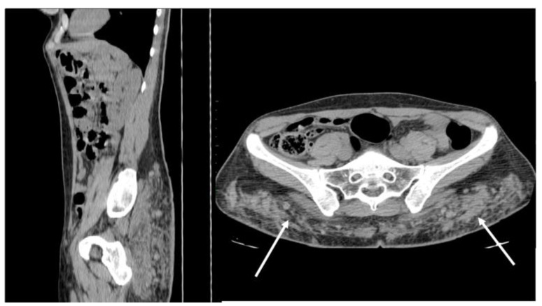 Figure 13