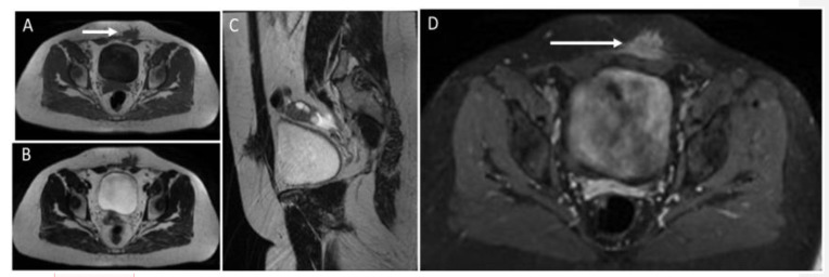 Figure 18