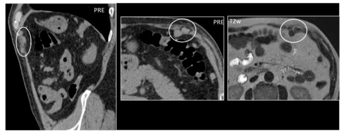 Figure 16