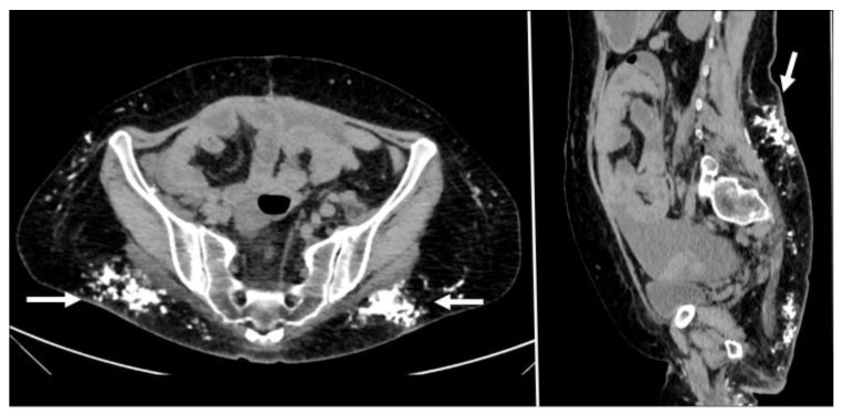 Figure 15