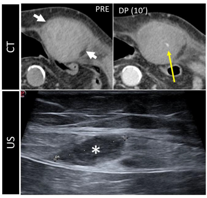 Figure 10