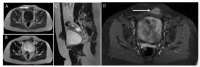 Figure 18