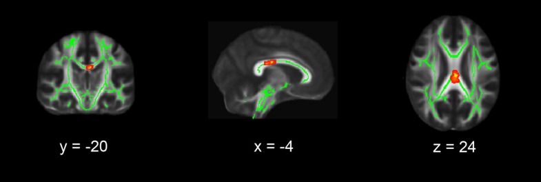 Fig. 2