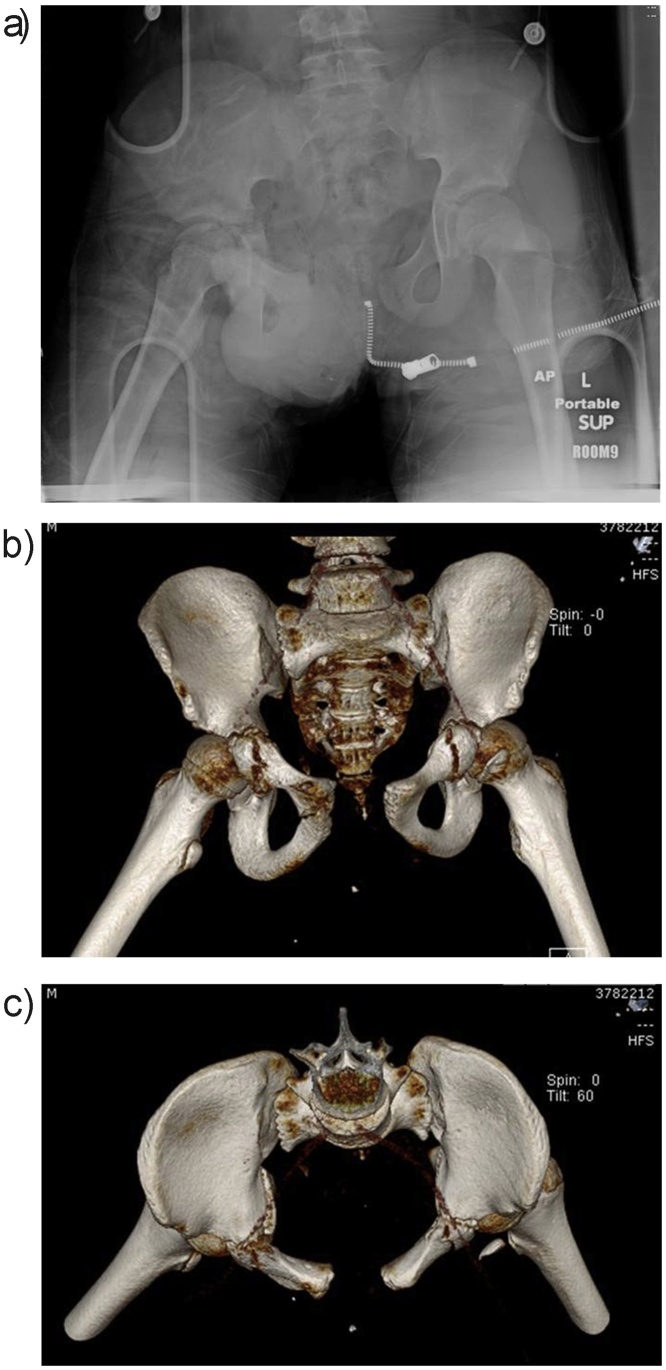 Fig. 1