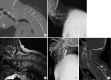 Fig. 9.