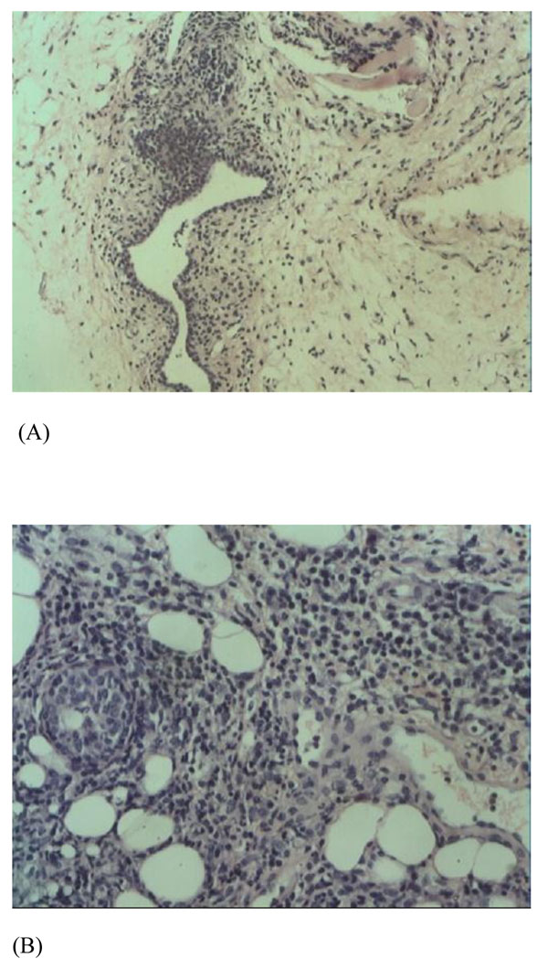 Mouse model of plasma cell mastitis - PMC