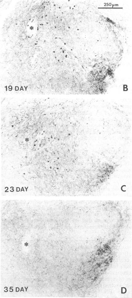 graphic file with name pnas00241-0364-a.jpg