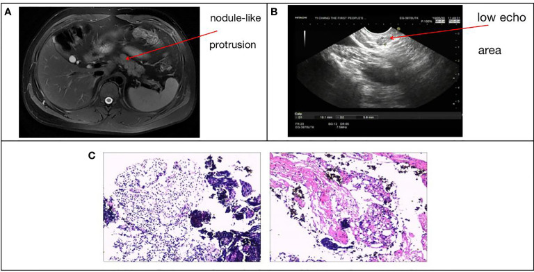 Figure 2