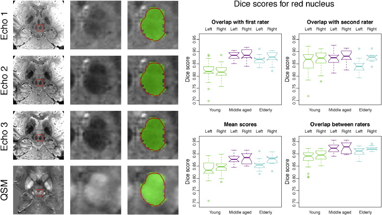 Fig. 4