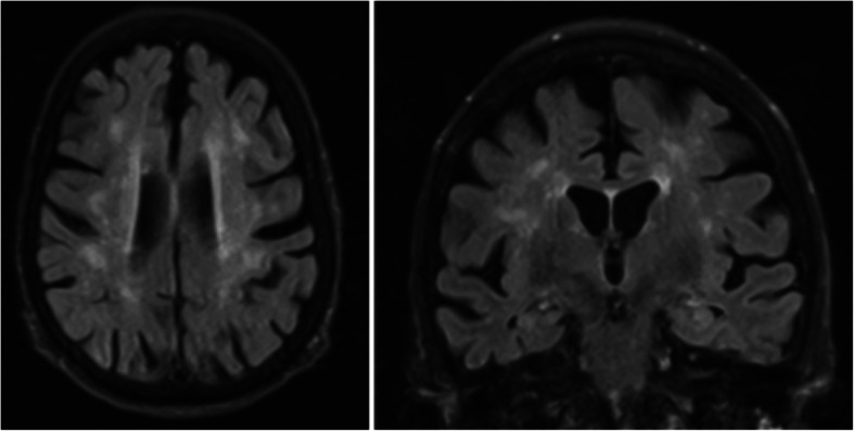 Fig. 2