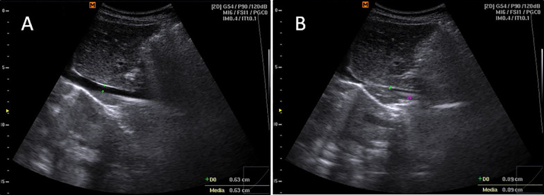 Fig. 2