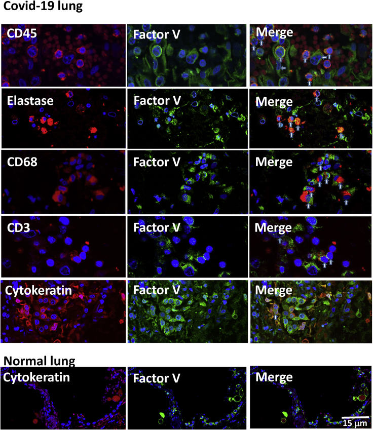 Figure 4