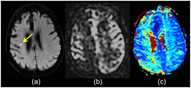 Figure 12