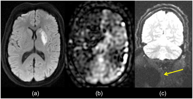 Figure 13