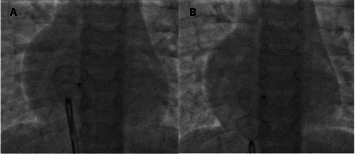 Fig. 6