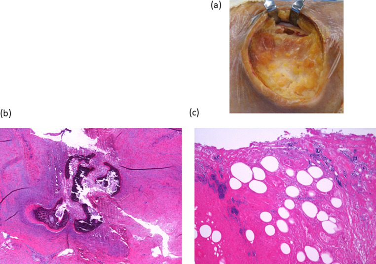 Fig 5