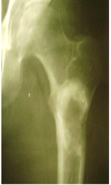 [Table/Fig-1]: