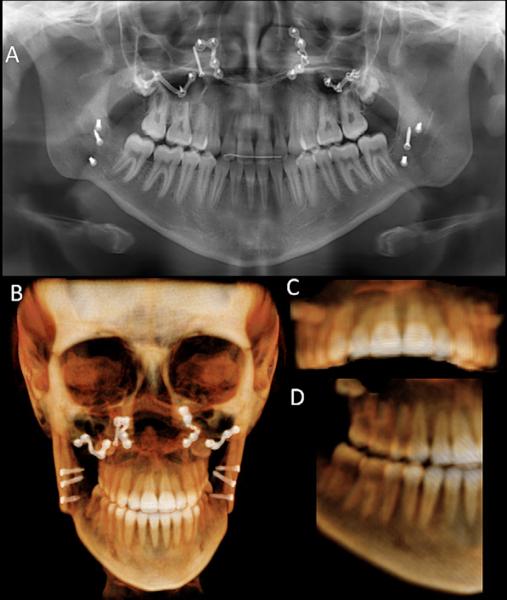 Fig 5