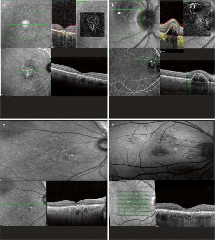 Fig. 4