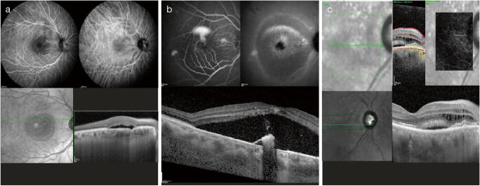 Fig. 3