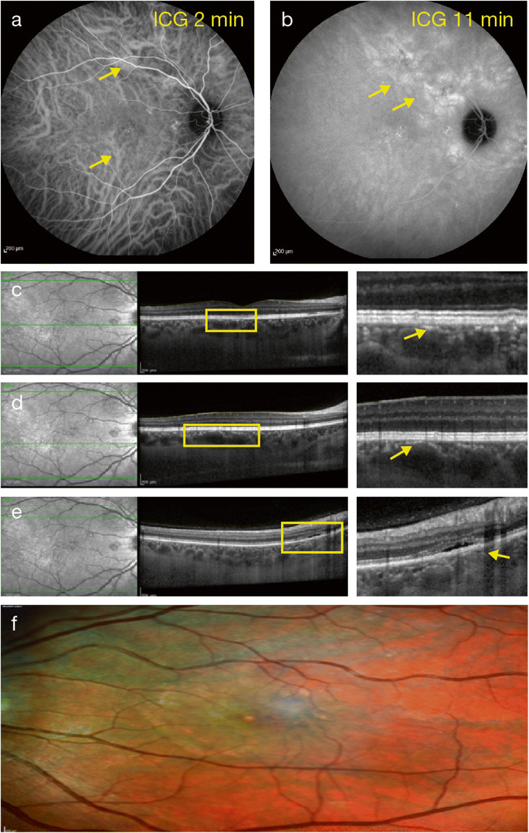 Fig. 2