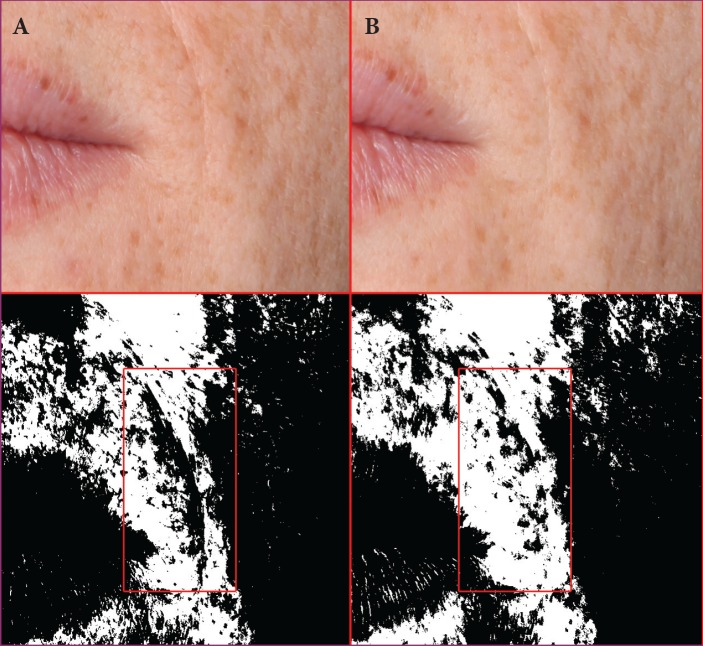 FIGURE 10.