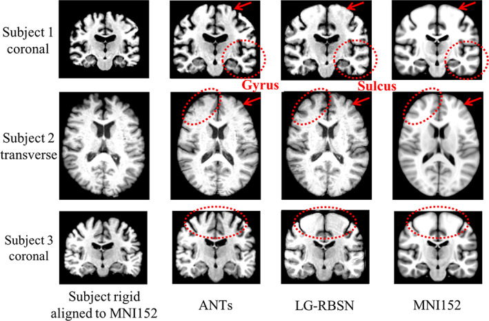 FIGURE 6