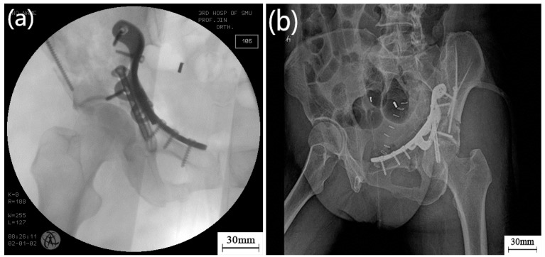 Figure 9