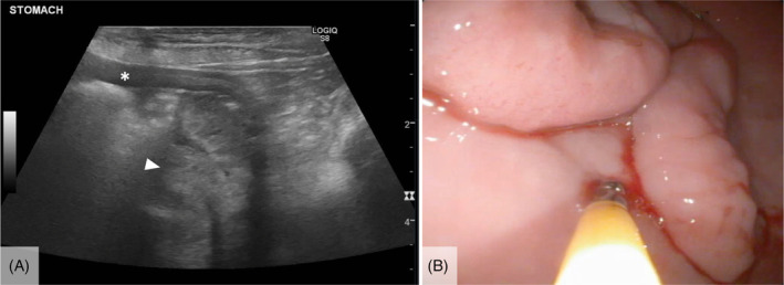 FIGURE 1