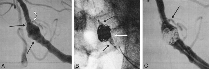 Fig 3.