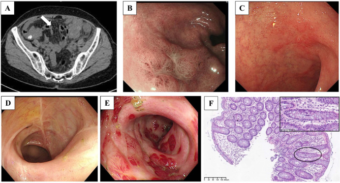 Fig. 1