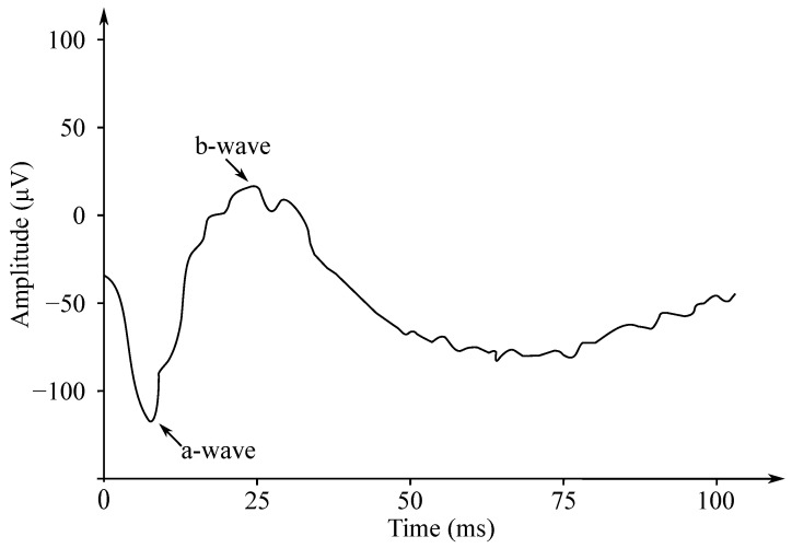 Figure 12