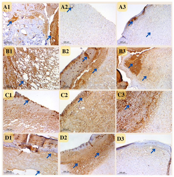 Figure 15