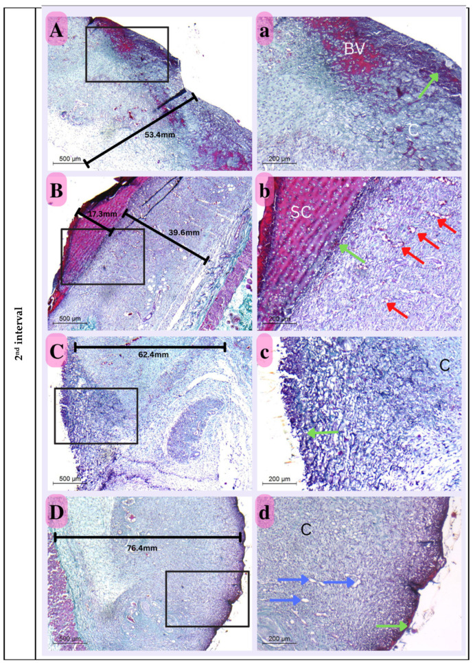 Figure 14