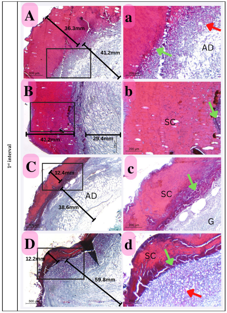 Figure 14