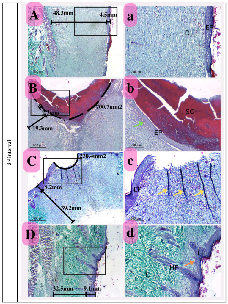 Figure 14