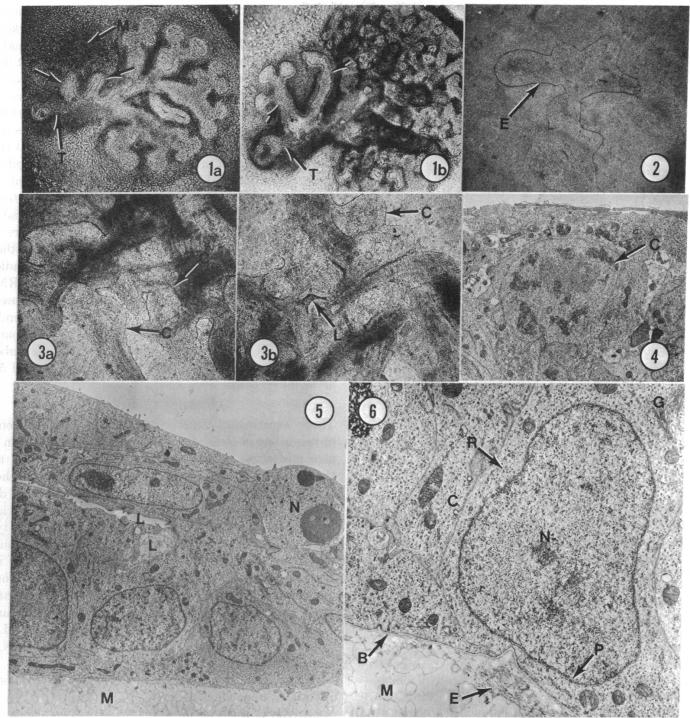 graphic file with name pnas00075-0111-a.jpg