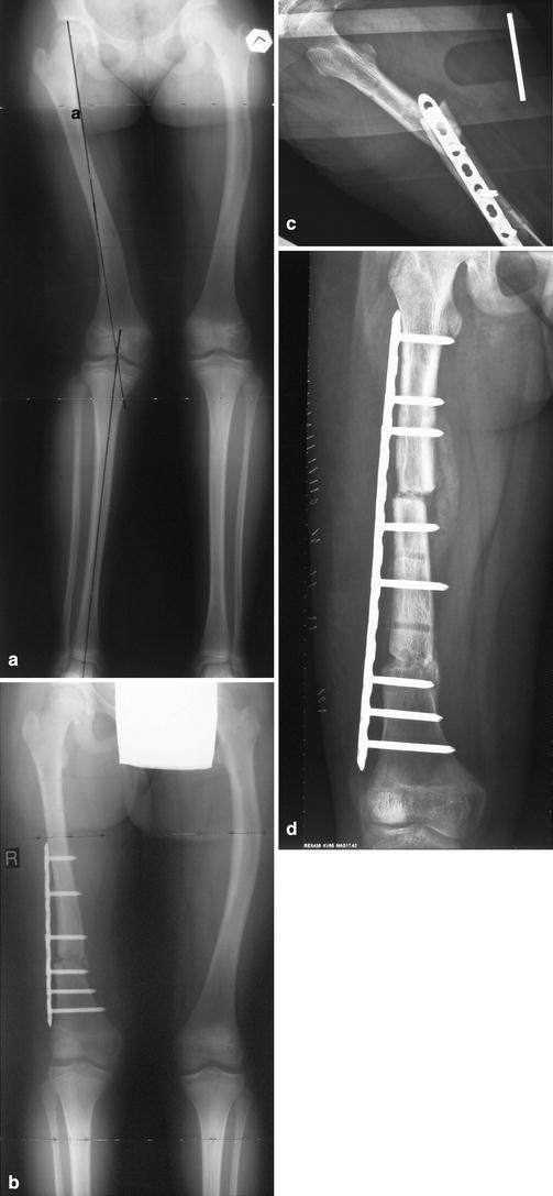 Fig. 6a–d