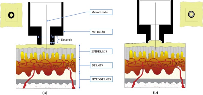 Fig. 1