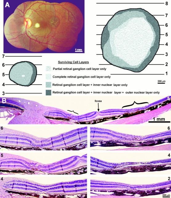 Fig. 11.