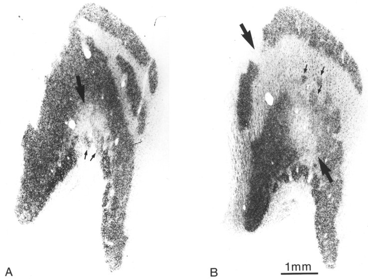 Fig. 14.