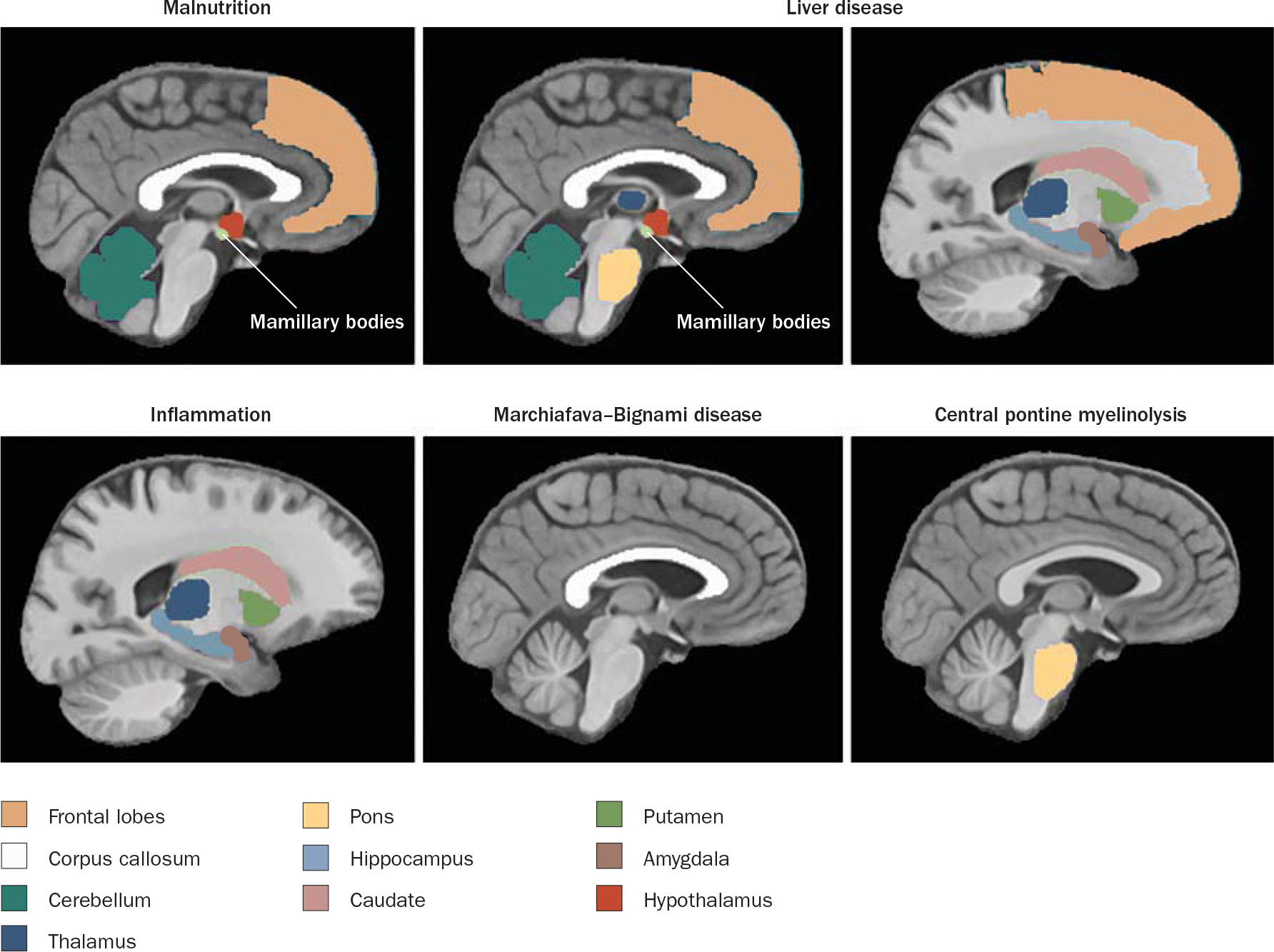 Figure 1 |