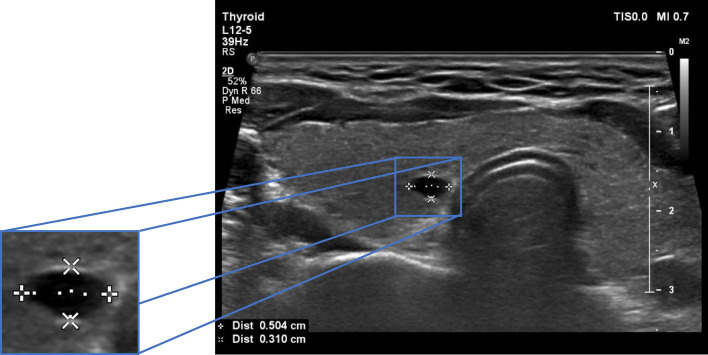Fig. 2