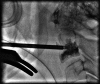 Fig. 10.