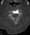 Fig. 14.