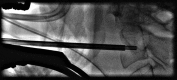 Fig. 8.